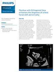 FlexVue with Orthogonal View enhances the diagnosis of a fetal facial cleft abnormality case study thumbnail