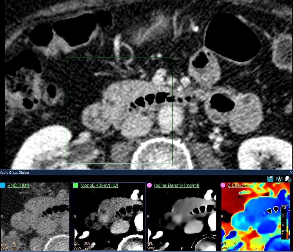 CT for the ED