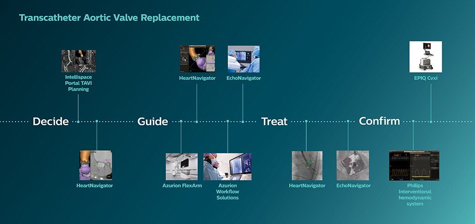 Transcatheter Aortic Valve Replacement