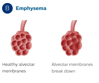Alveolære membraner