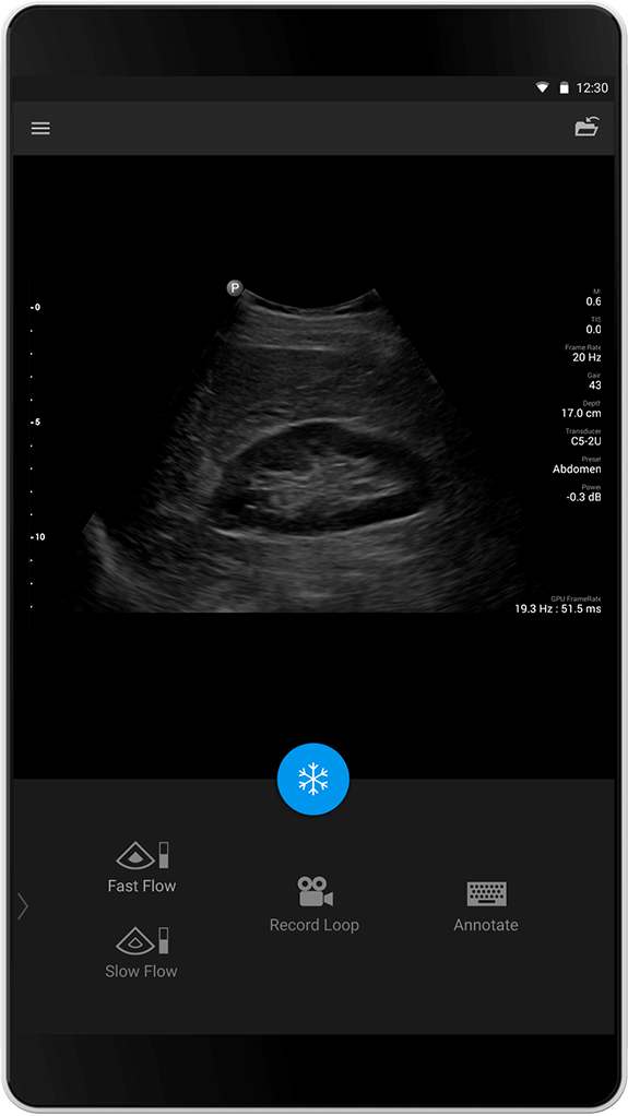 Abdomen Exam (Abdomenundersøkelse), C5-2