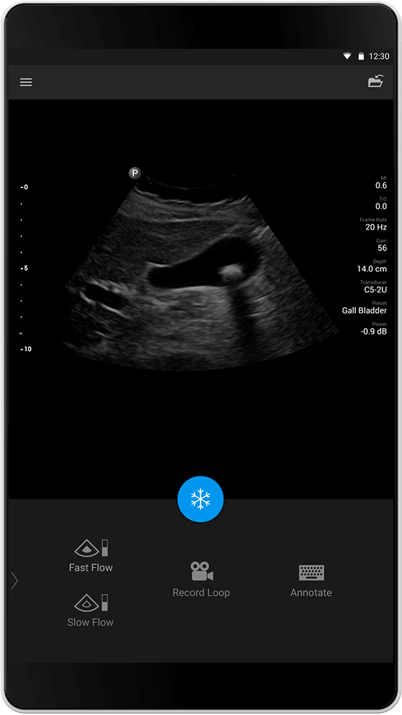 Gallbladder (Galleblære), C5-2