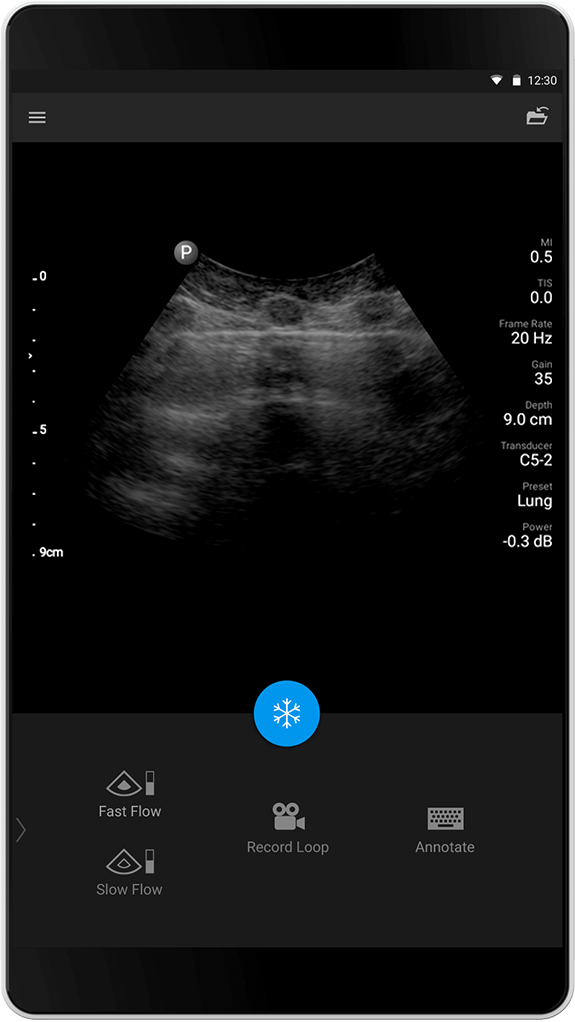 Lung exam (Lungeundersøkelse), C5-2