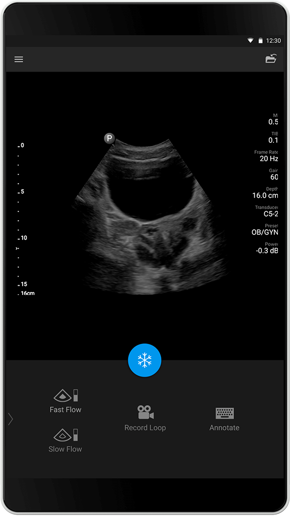 OB/GYN Exam (OB/GYN-undersøkelse), C5-2