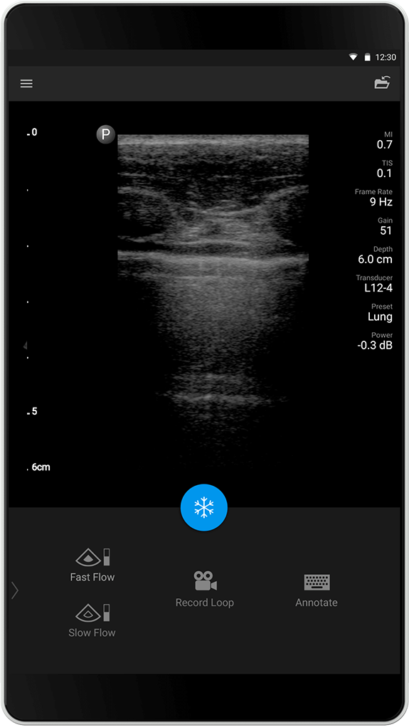 Lung Exam (Lungeundersøkelse)