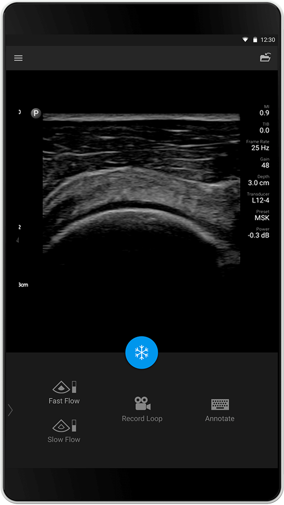 Lung Exam (Lungeundersøkelse)