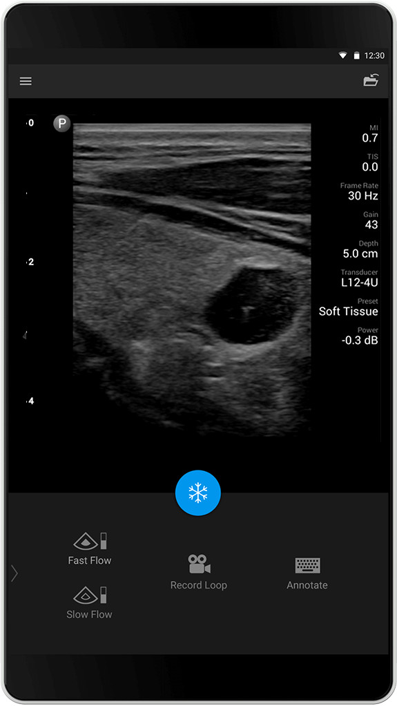 Soft Tissue Exam (Bløtvevsundersøkelse)