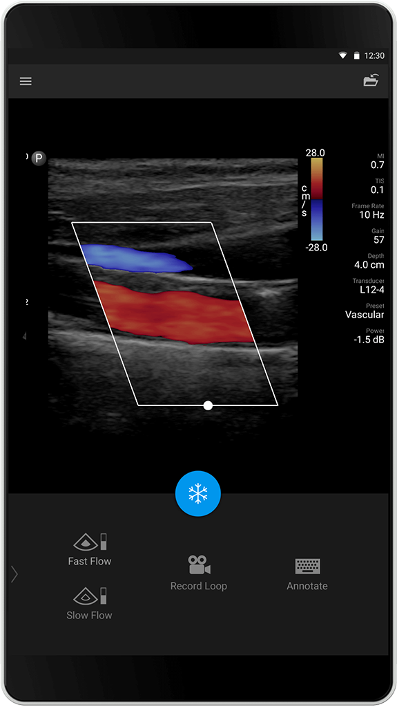 Vascular Exam (Vaskulær undersøkelse), L12-4