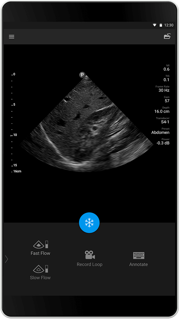 Abdomen Exam (Abdomenundersøkelse), S4-1