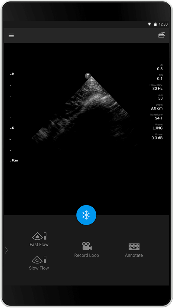 Lung exam (Lungeundersøkelse), S4-1