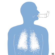 Inhalator med kammer