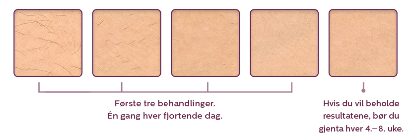Lumea IPL langvarig hårfjerning | Philips Philips Lumea Prestige IPL lysbasert hårfjerning BRI953
