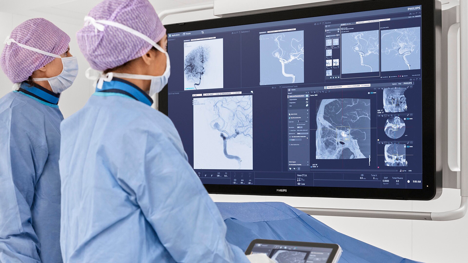 Philips at ESOC 2022: showcasing integrated solutions across the stroke care pathway