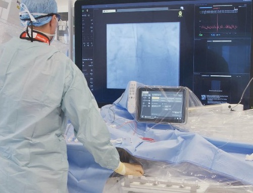 Philips introduces SmartIQ to address the trade-off between image quality and radiation dose in coronary procedures