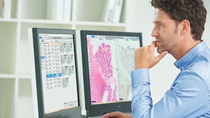 Leading pathology laboratories deploy tele-diagnostics with Philips during the COVID-19 pandemic 